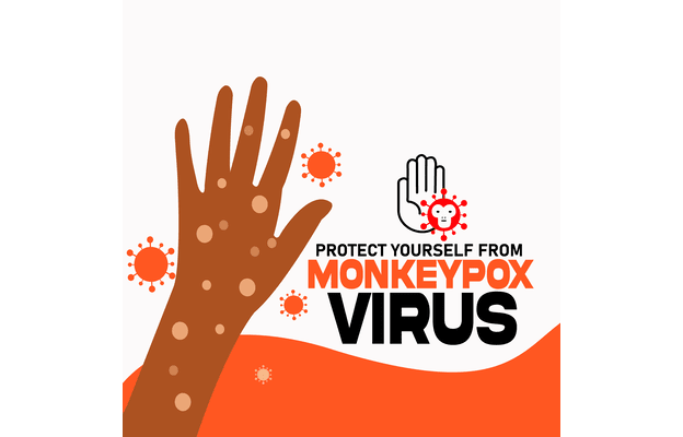 Monkeypox virus